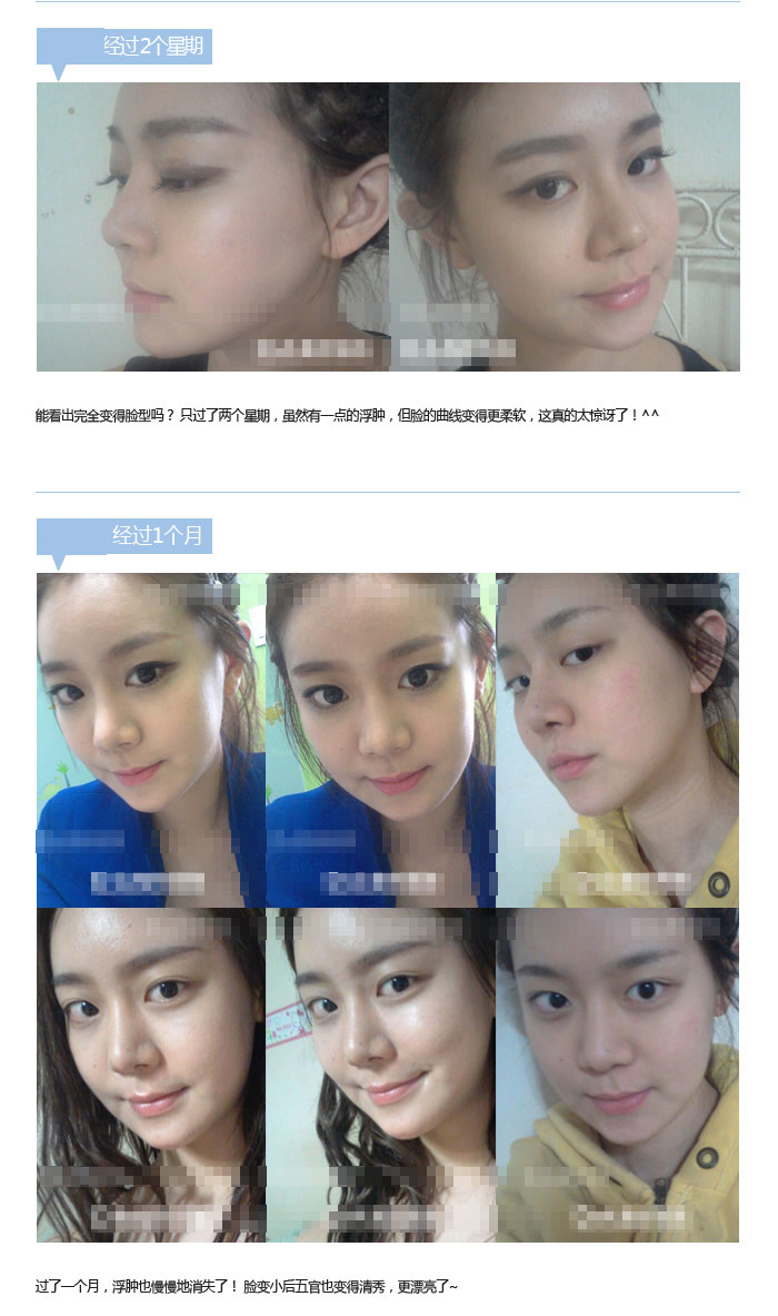 Park Joo Young ʵι