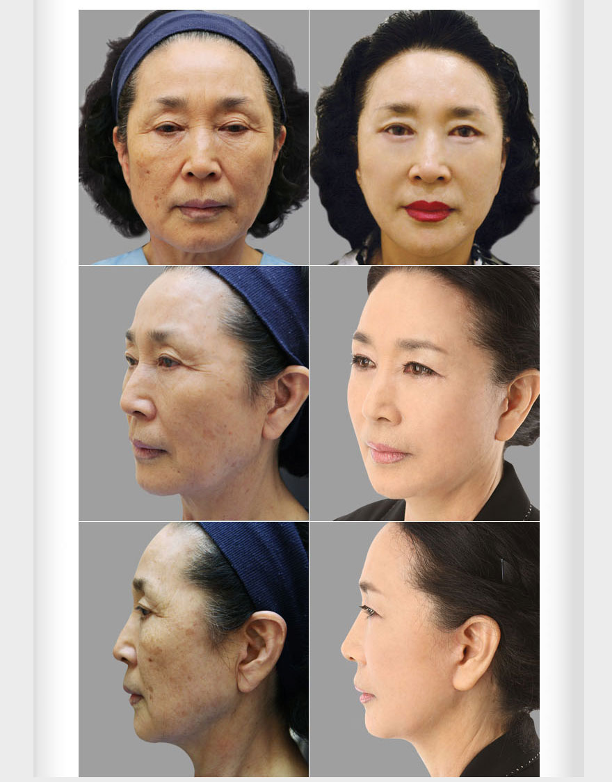 ����ҽԺ,��������ҽԺ,��������ҽ��,������־,��̩��,�۾�,��������,��ͷ,��ʵ���ι���