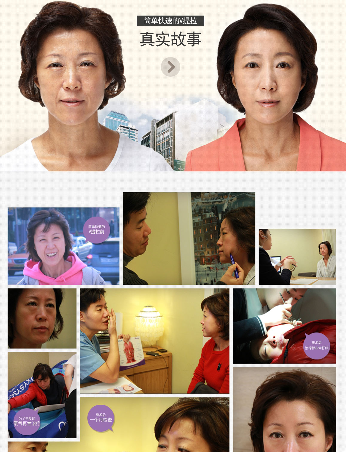 ��������,��������ҽԺ,���ǽ�������,������������,����������,�۲�����,֬������,΢��������,����,��������,��������,�沿����,��������,������С,��ͷ��С,������,¡��,�������,��������,�沿����,�������,ȧ������,�������,��������,����,ȧ��,ȧ����С,¡�°�,�°�����,���,�������,˫�,˫�����,�ذ���,���,V-line,V��,�ⶾ�˾�,������,���Ͳ��Գ�,ͻ��,��ͷ,¡��ͷ,��ͷ���,֬�����,����,����,����ҽԺ,�����������,��������,����,���������,�����������,����ͻ������,������������,�����������,����ȧ������,�������治�Գ�����,��������������,�������°�����,�����沿����,�����������,�����������,����ȧ������,�������°�����,����ͻ������,�������治�Գ�����,����������,�����°�����,�����°���