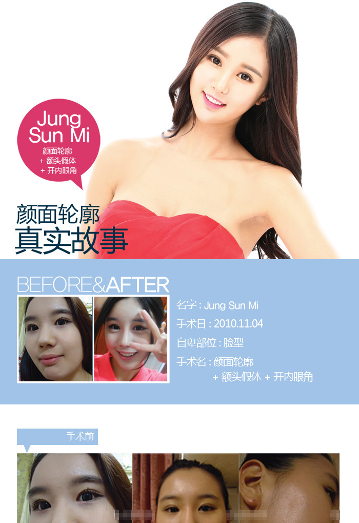  Jung Sun Mi +ͷ+۽ʵΰҽԺ,ҽԺ,ҽ,,ͷ,۽