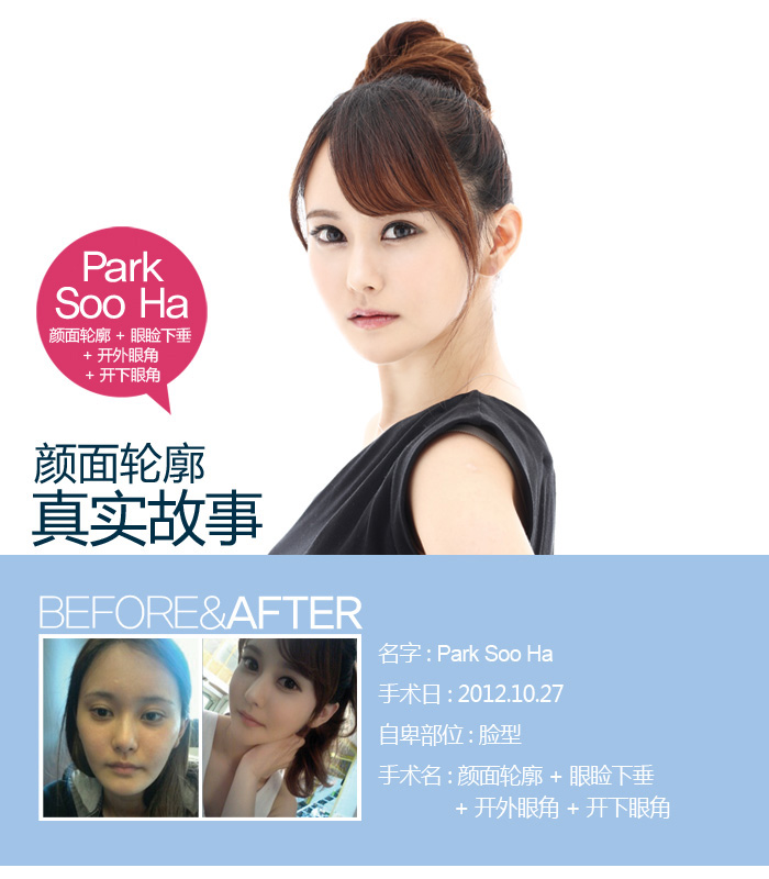 Park Soo Ha ��������+�����´�+�����۽�+�����۽���ʵ���ι��£�����ҽԺ,��������ҽԺ,��������ҽ��,��������+,�����´�,�����۽�,�����۽�,���ι���