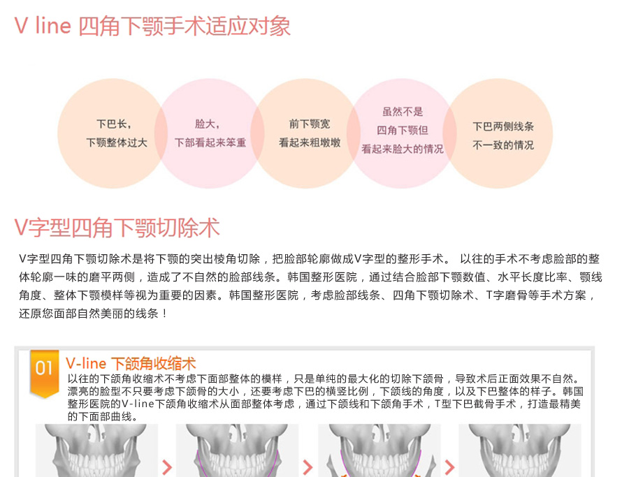 ��������,��������ҽԺ,��������ҽ��,V-line,����������