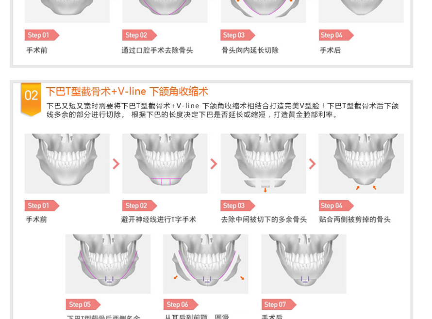 ��������,��������ҽԺ,��������ҽ��,V-line,����������