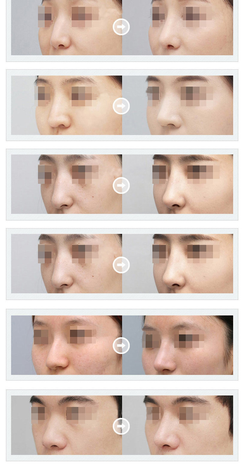 ����ҽԺ,��������ҽԺ,��������ҽ��,�Ǽ�����