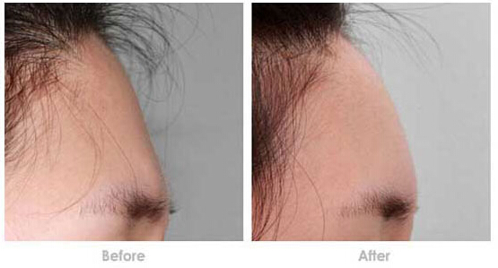 ��������,��������,���ͷ